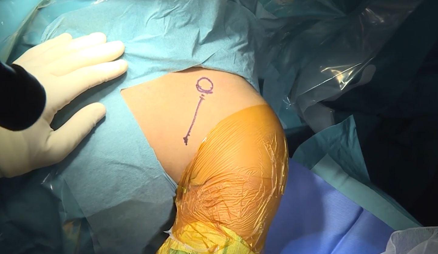 Arthroscopy doctor in nashik