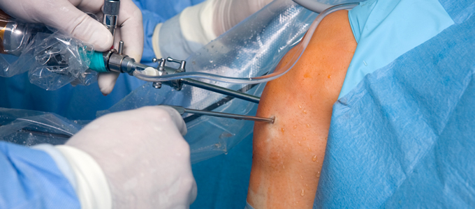 Arthroscopy treatment in nashik
